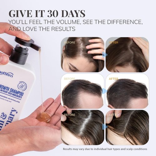 Biotin & Rosemary Shampoo - Hair Growth Formula for Thinning Hair | Sulfate-Free, 10 fl oz