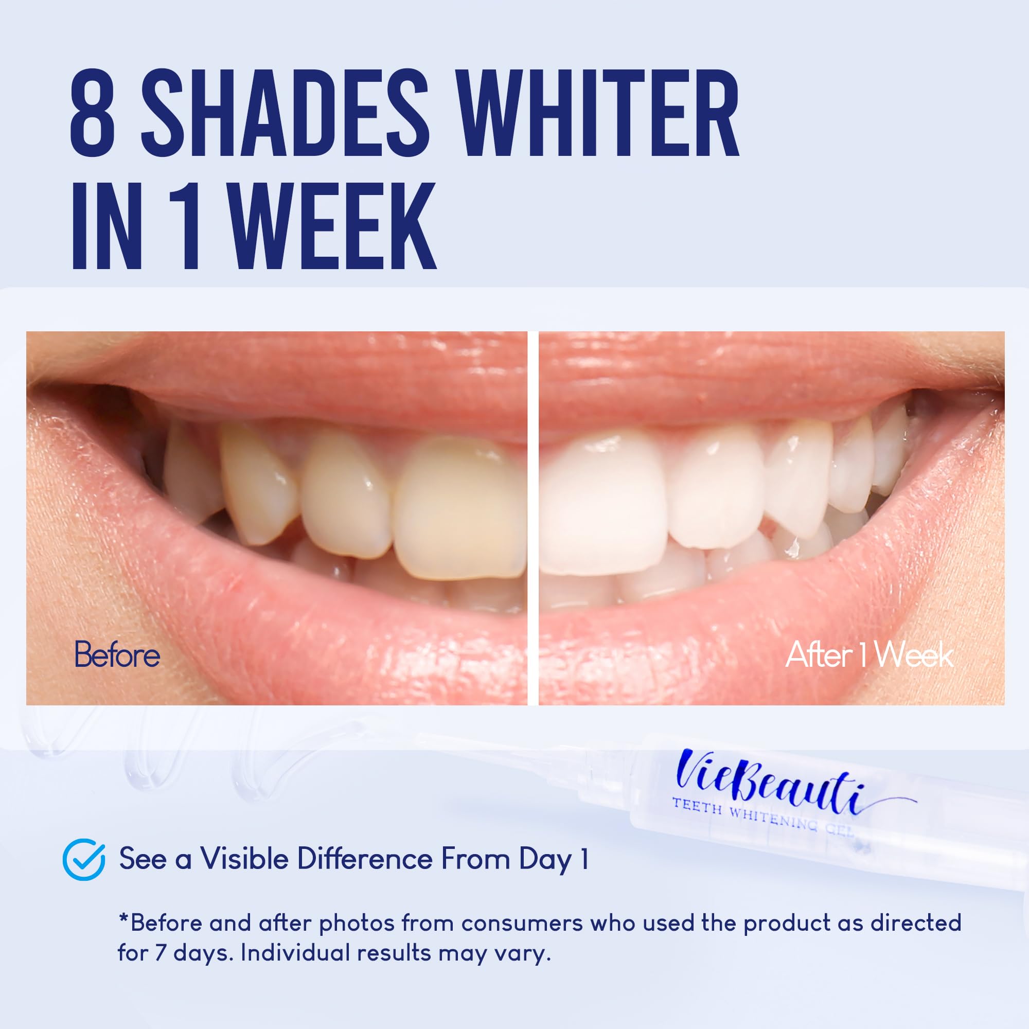 VieBeauti Teeth Whitening Kit with LED Light for Sensitive Teeth, 35% Carbamide Peroxide, Remineralizing Gel for Fast Results Cool Mint