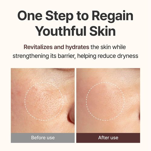 CENTELLIAN 24 PDRN Firming Boosting Ampoule - Enhanced Skin Elasticity | 1.01 fl oz with 300,000 ppm PDRN