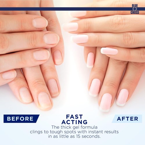Blue Cross Cuticle Remover Gel - Hydrating Nail Softener for Brittle Cuticles | 8oz Citrus Formula