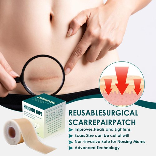 Silicone Scar Tape (1.6"x 120" Roll-3M), Premium Silicone Gel Scar Sheets, Reusable Silicone Patches, Soft Silicone Tape for Surgeries Scars, C-Sections, Wrinkles et