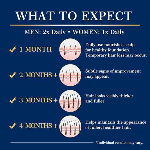 Regine Switzerland Minoxidil Hair Growth Spray Kit - Extra Strength Treatment for Thinning Hair & Beard - 2PCS