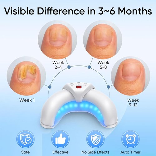 Skiennix Home Toenail Repair Treatment - Multi-Mode Solution for Toenails & Fingernails
