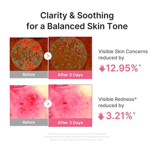 Medicube PDRN Pink Peptide Serum - Ultra-Light Hydrating Formula with Salmon DNA | Fast-Absorbing Glow Care, 1.01 fl. Oz