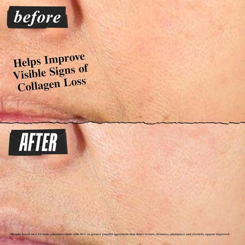 Kiehl's Super Multi-Corrective Cream - Anti-Aging Face & Neck Cream for Even Skin Tone | Lightweight & Fast-Absorbing