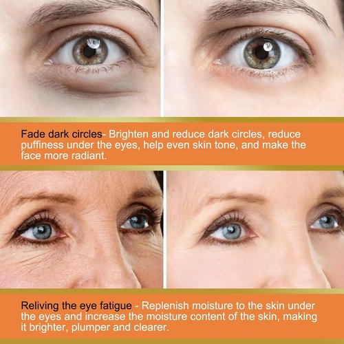 LOYOTICE Vitamin C Eye Balm - Hydrating & Brightening Cream Stick for Dark Circles | 3 Pcs Set