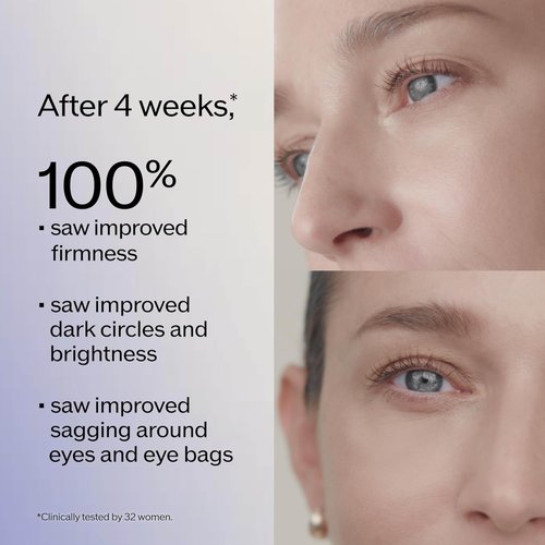 Shiseido Vital Perfection Eye Cream - Uplifting & Firming Formula - 15 mL with Massage Roller Tool