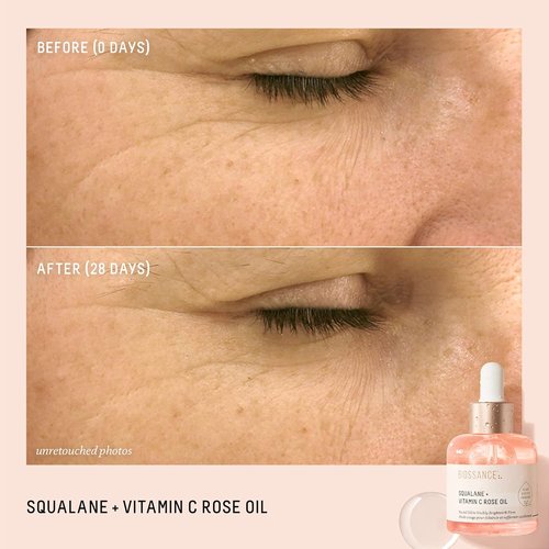 BIOSSANCE Squalane + Vitamin C Rose Facial Oil - Brightening & Hydrating Serum for All Skin Types | 1 oz