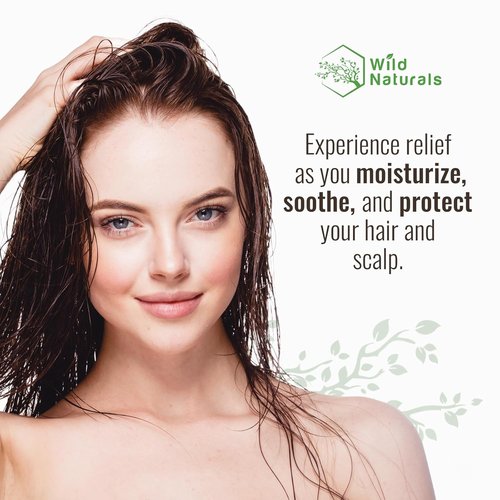 Skiennix Natural Hydrating Conditioner - Sulfate-Free Dandruff Relief with Aloe Vera & Manuka Honey | Ideal for Oily & Curly Hair, Promotes Hair Growth