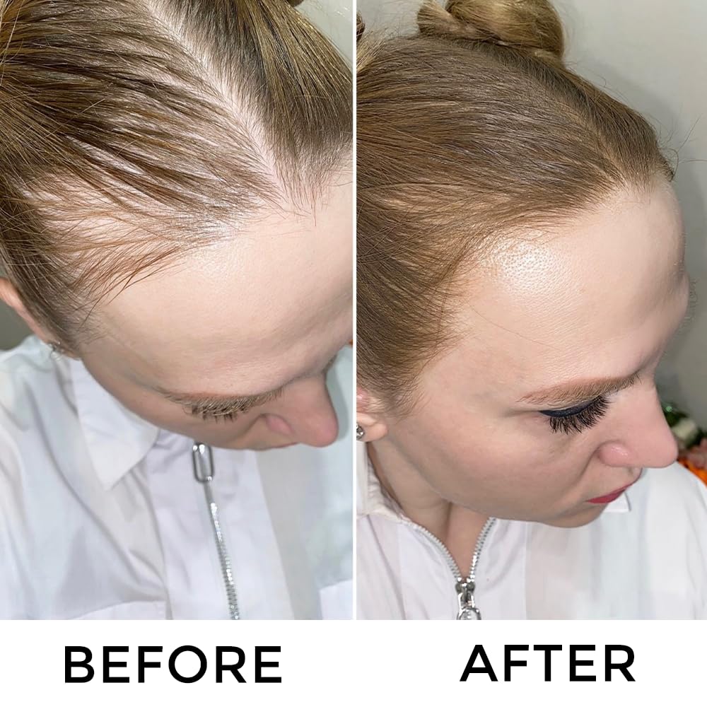VOLLUCK Root Touch Up Hair Color Spray - Ammonia-Free, Quick Drying Grey Coverage for Men & Women | Black