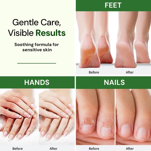 Natural Foot, Nail & Hand Cream - Skin Care & Nourishing Formula – Rich Hydration with Raspberry Scent, Daily Repair Cream for Men & Women, Softens, Protects & Restores Skin – 8oz