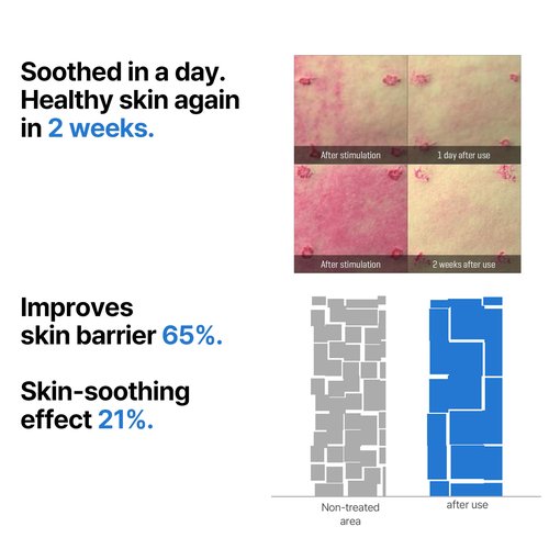 SOME BY MI Beta-Panthenol Repair Serum – 1.01oz, 30ml – Korean Hydrating Hyaluronic Acid Serum for Face – Daily Barrier Repair & Soothing Formula with Beta-Sitosterol & Panthenol – Korean Skin Care