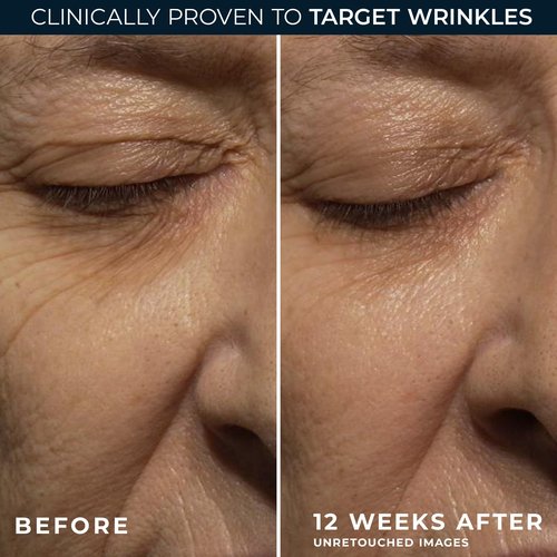 RoC Retinol Correxion Night Cream for Deep Wrinkles, Anti Aging Skincare Treatment Women and Men, 1.0 oz (Packaging May Vary)