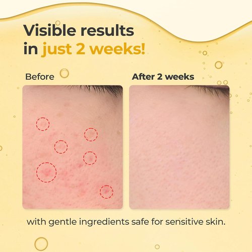 Glutathione All-In-One Brightening Serum - Niacinamide, Kojic Acid & Turmeric for Radiant, Even-Tone Skin