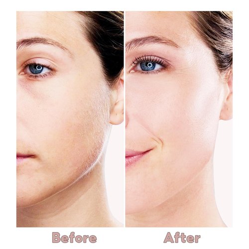 innobeaut Facial Hair Removal for Women, Electric Painless Facial Hair Remover for Face, Lip, Chin with USB Rechargeable and 2 Replacement Heads,Rose Gold