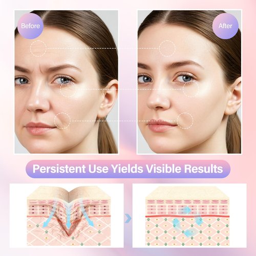Neck and Face Care Device for Home Daily Use, Skin Care Tool, Wrink-le Improve, Firm, Tightening and Smooth Cream White