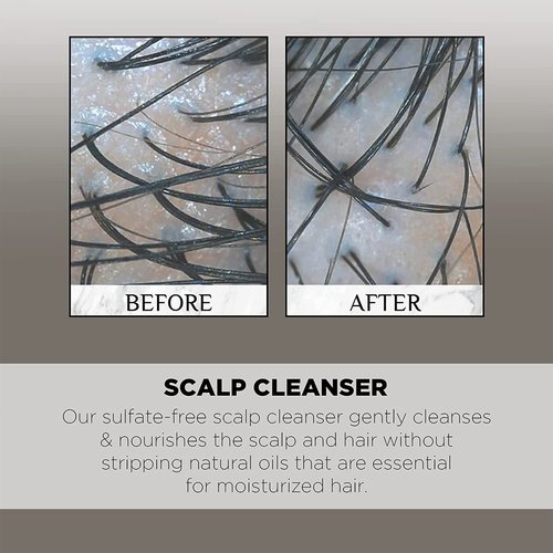 Controlled Chaos Hair & Scalp Cleanser – Low-Foaming Cleanser Calms, Soothes & Balances Scalp, Hydrates Dry Hair & Supports Healthy Hair Regrowth – Free of Sulfates, Parabens & Phthalates, Made in USA