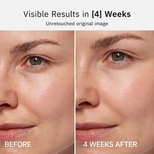 HKH Vitamin C Serum Capsules - Anti-Aging Face Treatment with Vitamin E | 48 Caps for Smoother, Firmer Skin
