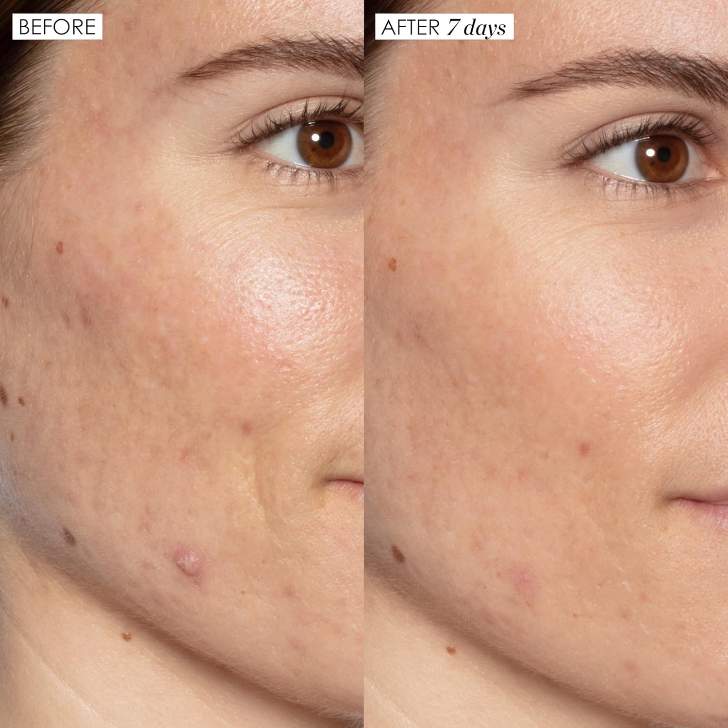 Sunday Riley Good Genes Lactic Acid Treatment Serum - All-in-One Anti-Aging Solution