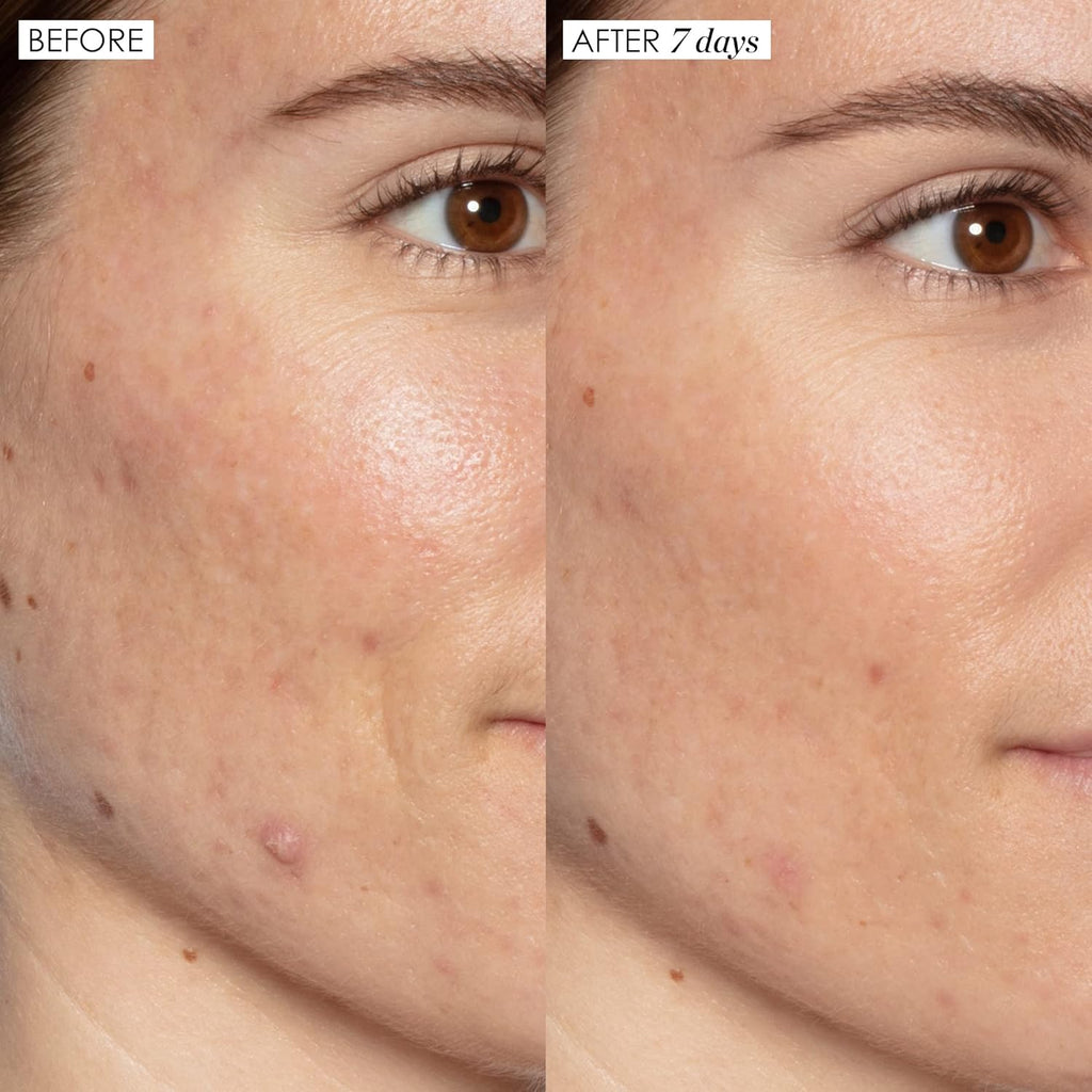 Sunday Riley Good Genes Lactic Acid Treatment Serum - Radiant Skin Booster for All Skin Types