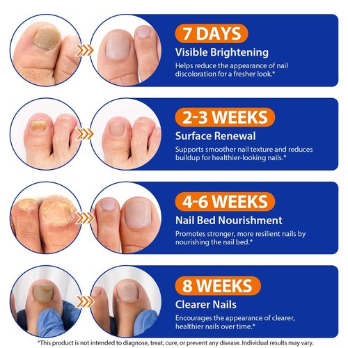 Toenail Treatment Extra Strength - 32 Pcs Nighttime Nail Patches, Overnight Toe Nail Treatments for Damaged Nails Foot Nails Repair and Care, 8-Hour Restores Healthy Appearance (2PCS)