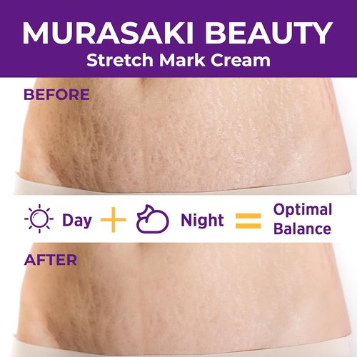 Skiennix Stretch Mark Cream - Nourishing Maternity Formula for Prevention & Elasticity | 4 oz (120g) (2 Pack)