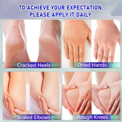 BERVEAL Urea Cream with 2% Salicylic Acid Foot Cream for Dry Cracked Heels, Heel Care Cream 5.29 Oz (Pack of 1)