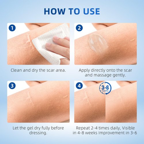 Silicone Scar Gel for Old and New Scars, Stretch Marks & Acne Scar Removal, Advanced Silicone Scar Cream for Surgical, Burn, Keloid, Injury & Acne Scars, Fast Absorbing Gel, 1.76 oz (50ml)