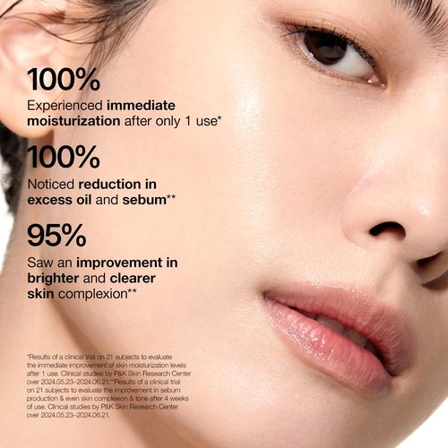 Anua Rice 70 Glow Milky Toner, Glass & Dewy Skin, Hydrating & Barrier Care, Rice Water, Niacinamide, Ceramides, All Skin Types, Fragrance-Free, Non Comedogenic, Korean Skincare, 8.45fl.oz