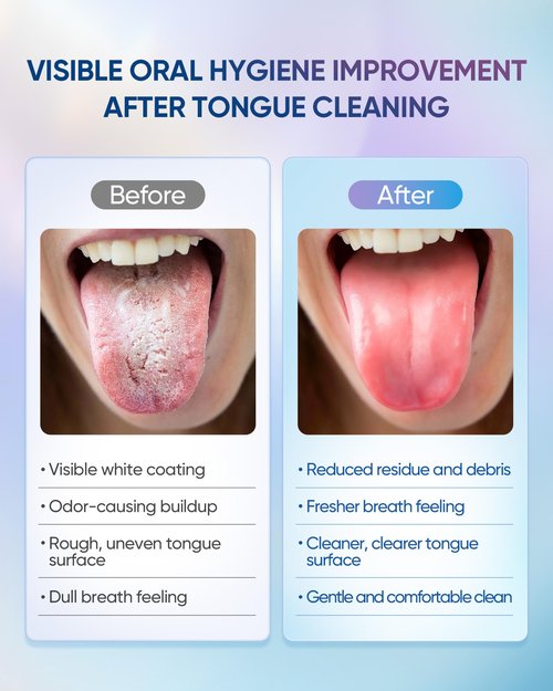 BodyAccel Tongue Cleaner Gel with Tongue Brush – Fresh Breath Oral Care Kit – Tongue Scraper Gel Set for Bad Breath Removal, Maintain Oral Health