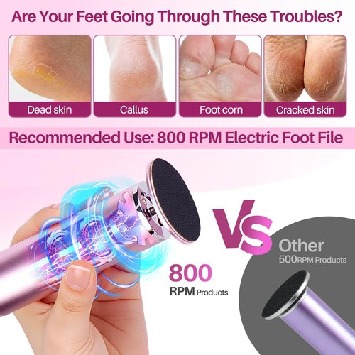 LIONVISON Electric Foot Callus Remover: Adjustable Speed Foot File for Cracked Heels - Working Women's Summer Pedicure Tool with 60pcs Sandpaper Discs - Dead Skin Remover for Dry Feet at-Home