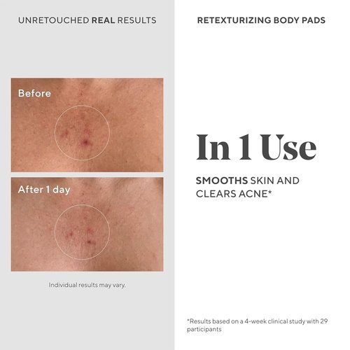 Murad Retexturizing Body Pads - Acne-Fighting Exfoliating Pads with Azelaic, Salicylic & Glycolic Acid | 45 Pads for Smooth, Clear Skin