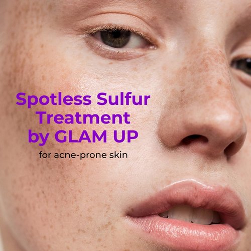 GLAM UP Spotless 10% Sulfur Treatment Serum - Fast Healing for Pimples & Acne | 15mL (0.5 fl. oz.)