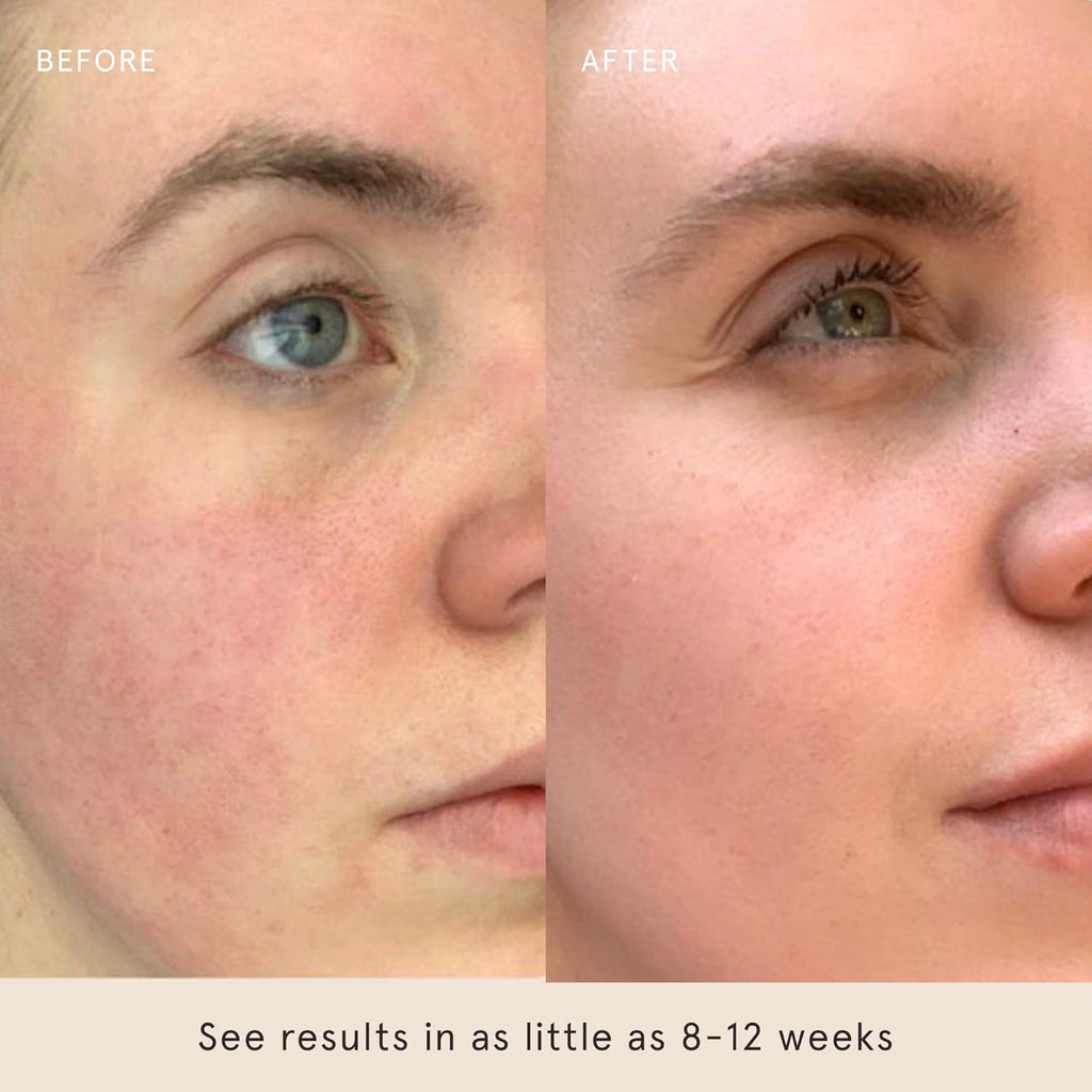 Barefaced Sheer Protection SPF 50+ | Broad-Spectrum Face Sunscreen with Zinc Oxide, Niacinamide & Hyaluronic Acid – Oil-Free Hydration & Anti-Aging (60ml)