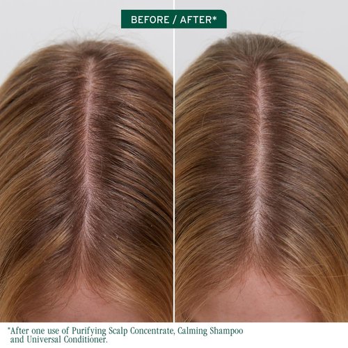 Biolage Scalp Sync Purifying Concentrate - Exfoliating Dry Scalp Treatment with Fermented Tea & Glycolic Acid