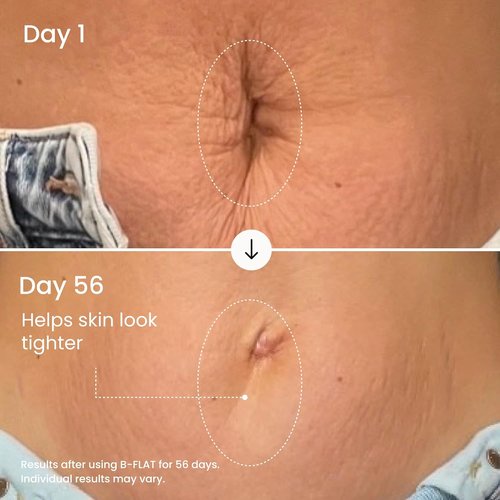 MAËLYS B-FLAT Belly Firming Cream - Skin Tightening & Moisturizing Treatment with Shea Butter | 3.4 Fl Oz