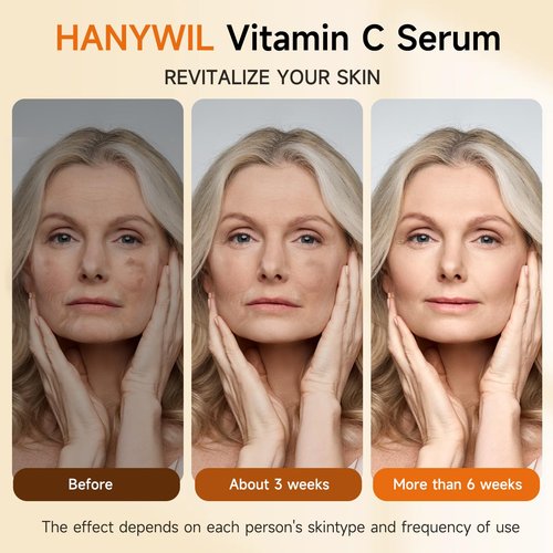 HANYWIL 20% Super Vitamin C Serum for Mature Skin, Targets Age Spot & Wrinkle Reduction with Hyaluronic Acid, Hydrating Anti-Age Serum 1.7fl oz
