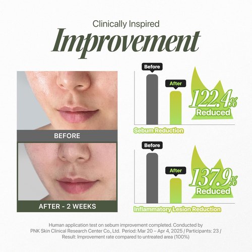 EIOM Trouble Patch Mask – Acne Face Mask & Full-Face Hydrocolloid Acne Mask for Acne-Prone Skin, Skin-Balancing Reset Care with Tea Tree Biome, Korean Face Mask (20ml x 4), Valentine’s Gift