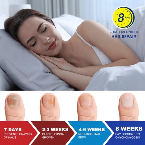 Toenail Fungus Treatment Extra Strength - 42 Pcs Fungal Nail Patches, nail repair patches-8-Hour Firm Adhesion, Nail Repair patches for Damaged Nails, Overnight Renewal for Men and Women