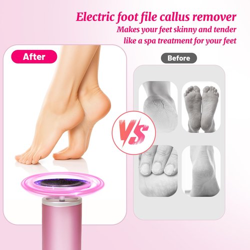 AiDwell Electric Foot Callus Remover with 80pcs Sandpape Discs, Professional 800RPM Aluminum, Callus Remover for Feet Pedicure Tool for Dead Skin and Calluses, Stepless Speed Control Foot File 2 in 1