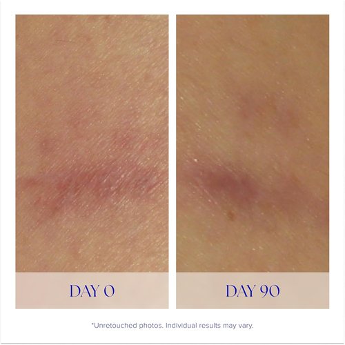 iS CLINICAL Super Serum Advance+ | Anti-Aging Vitamin C Face Serum for Scars & Fine Lines