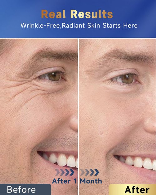 Felicemy 6-in-1 Face Cream for Men - Anti-Aging Moisturizer with Retinol & Hyaluronic Acid | 1.7 Fl Oz