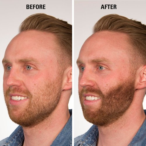 INFINITY Hair Fibers Black for Thinning Hair for Women & Men - 100% Undetectable Hair Building Fiber Powder - Conceal Hair Loss in 15 Seconds, 30g
