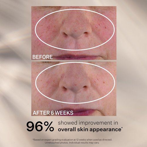 StriVectin Advanced Retinol Nightly Multi-Correct Serum