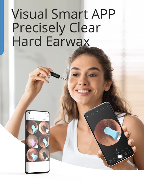 BEBIRD R1 Wax Removal Tool for Ear - Spade Ear Canal Cleaner with Camera 1080P Earscope, Wax Remove Ear Picker with Vari Replacement Tips, Camera with 6LED Light for Ear/Nose/Throat Examination, Blue