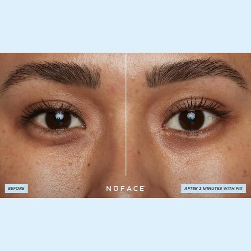 NuFACE IonPlex Hydra-Gel Under Eye Patches - Cooling Treatment for Puffy Eyes & Dark Circles | 60 Count