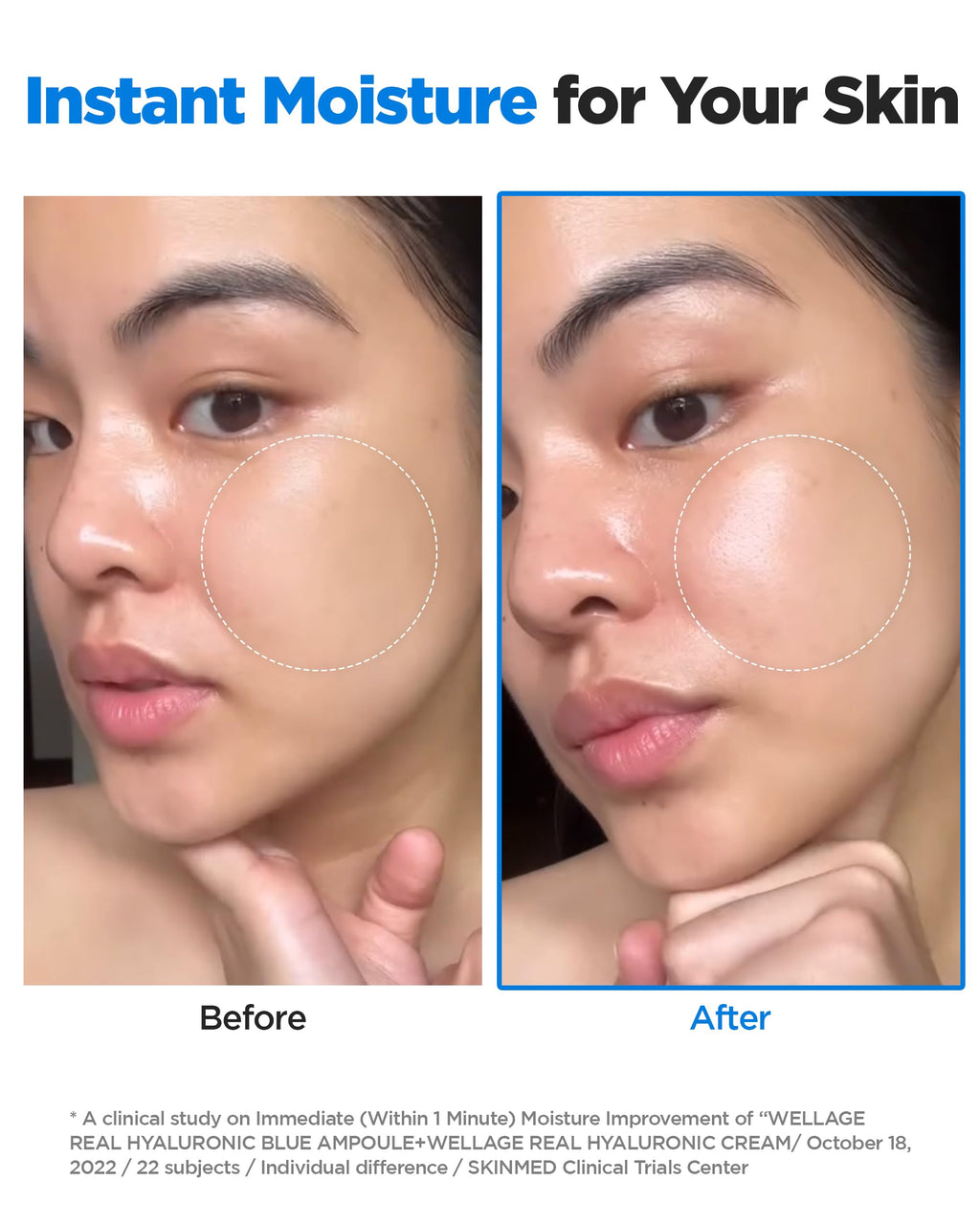 WELLAGE Real Hyaluronic Blue Ampoule 100, Korean Hydrating Serum for Face, Fragrance Free Hyaluronic Acid Deep Moisturizing Serum with Panthenol, PDRN for Sensitive Dry Skin Moisturizer, 2.54 Fl Oz_R