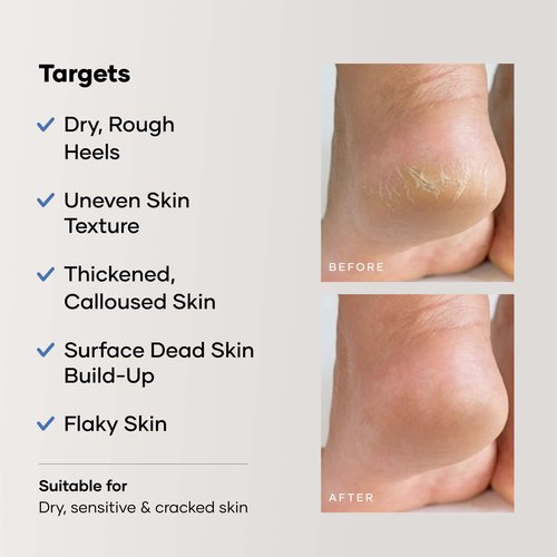 Cureskin Foot Care Cream for Cracked Heels | Repairs, Softens, and Exfoliates | Foot Cream for Women and Men, 50 g (Pack of 1)