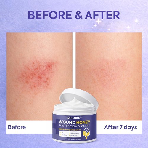 Dr. Luke Manuka Honey Wound care: Medihoney Wound Gel for Minor wounds & Skin Repair - Manuka Honey Medical Grade with Akkantoin 0.5% & Vitamin E - 2.82 oz (80g)