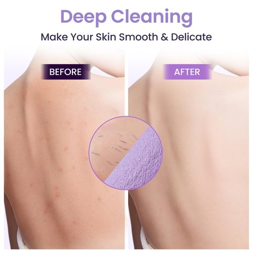3 Pcs Double-Sided Back Exfoliator Body Scrub Towel, Exfoliating Back Scrubber with Handles,Exfoliating Washcloth Bath Tool in Shower, Stretchable Back Washer to Deep Cleans Skin (Beige,Pink,Purple)